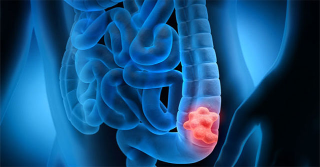 Why do many young people have cancer?