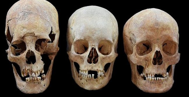 Why do medieval women have an alien-like skull?