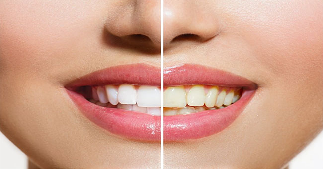 Why do our teeth turn yellow?