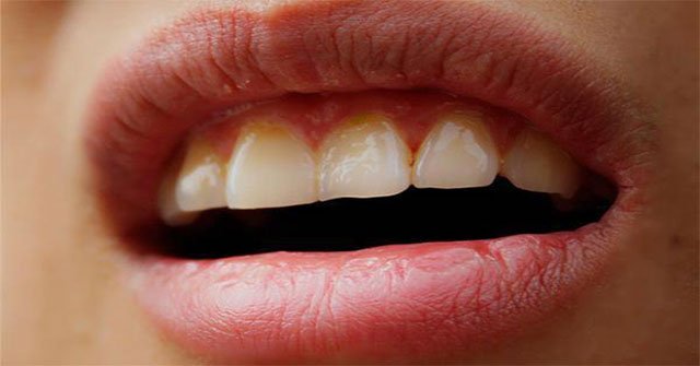 Why do so many people suffer from dry mouth and bitterness when they wake up in the morning?