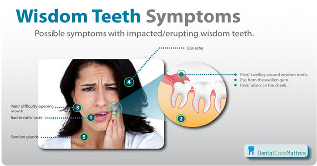 Why do they grow so stupid they still have the name wisdom teeth?