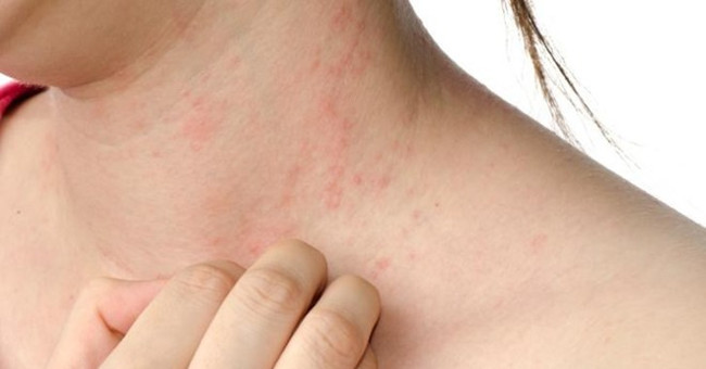 Why do you often have itching when it's cold?