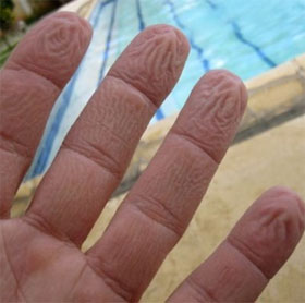 Why do young people's hands get wrinkled when soaking in water, do old people hands?