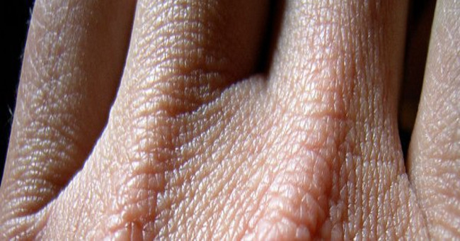 Why does body fluids not leak through the skin?