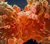 Why does cancer attack kill humans?