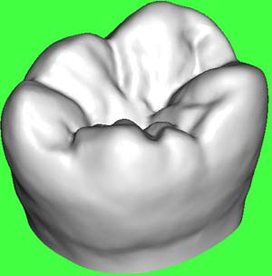 Why does the wisdom tooth usually sore?