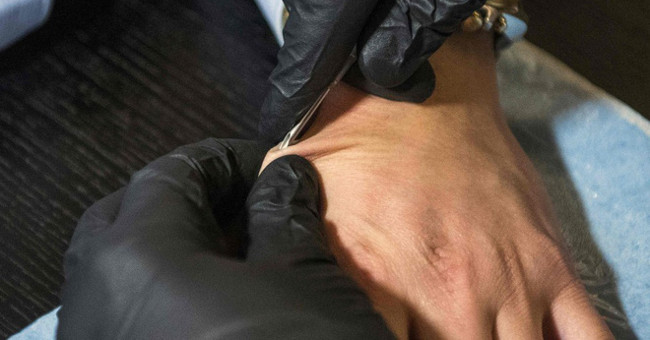 Why in Sweden, everyone implanted this chip in hand?