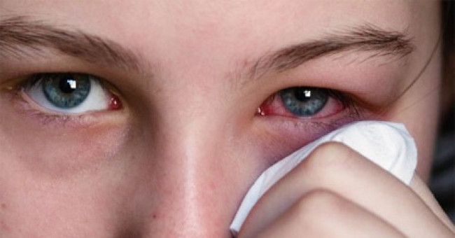 Why is red eye pain transmitted through inhalation?