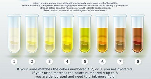 Why is urine yellow?