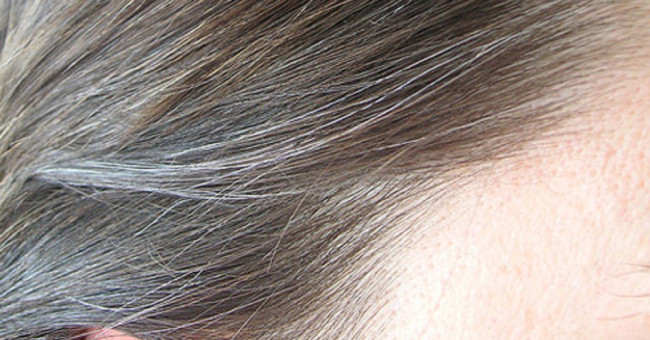Why silver hair back?