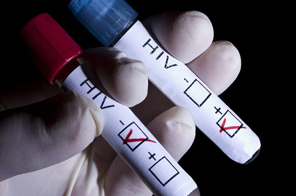 Will HIV be eliminated in 2030?