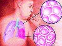 Winter and bronchopneumonia in children