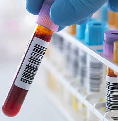 Women should be tested with what?