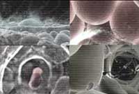 Women suffer from cancer better than men