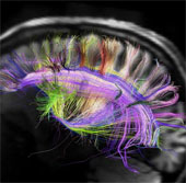Women's brains recover faster than men
