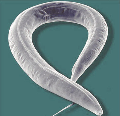 Worms live in the universe