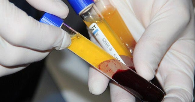 Young human plasma helps fight aging