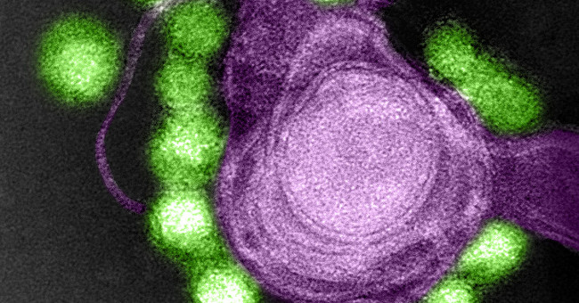 Zika virus kills brain cancer cells