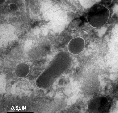 Picture 1 of Detect shivers about living things in cancer cells