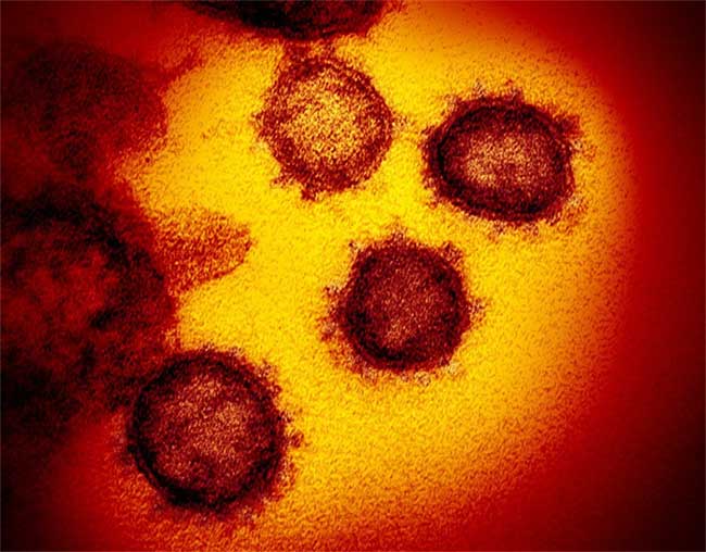 Picture 1 of Detecting mutant corona virus, able to spread stronger than before