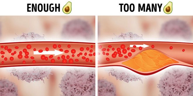 Picture 4 of Science explains bad eating habits that people still think are healthy