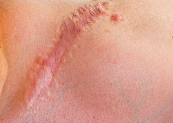 Picture 2 of Scientists have invented a gel that can heal all body and internal wounds