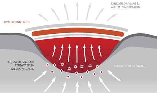 Picture 4 of Scientists have invented a gel that can heal all body and internal wounds