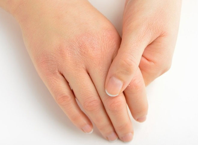 Picture 6 of Signs that the body is having problems