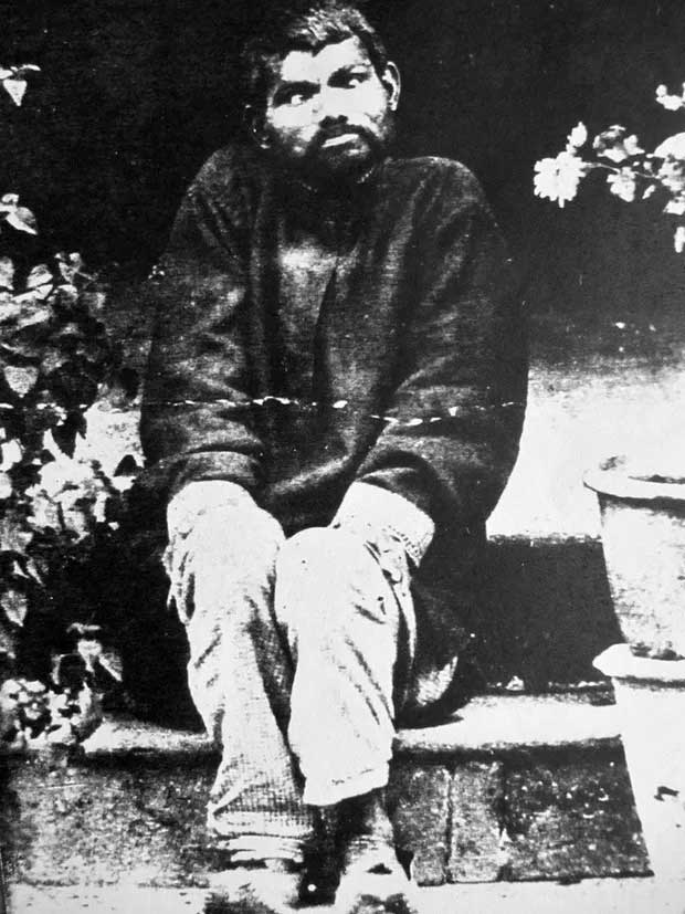 Picture 1 of The real life prototype of the jungle boy: Unable to speak human language, live like a handicapped man and die in illness after 20 years of leaving the pack