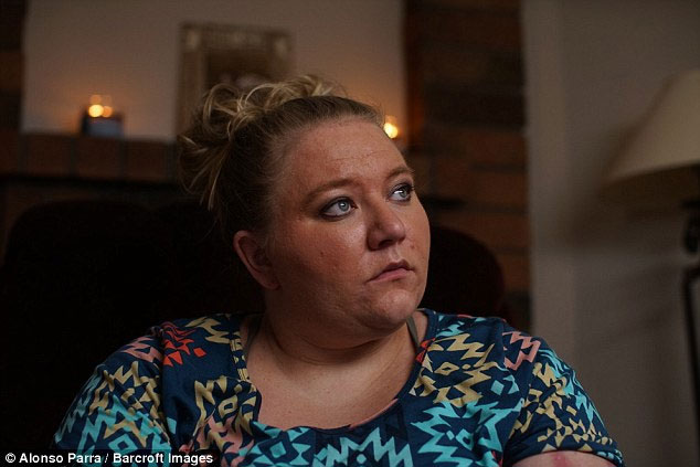 Picture 1 of The woman with the most painful disease in the world