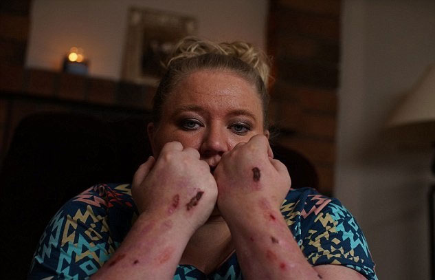 Picture 3 of The woman with the most painful disease in the world