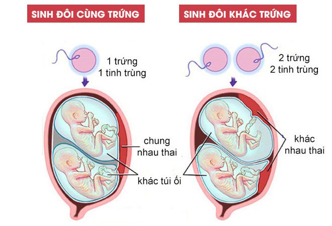 Picture 2 of Twins: An evolutionary mystery or just an accident?