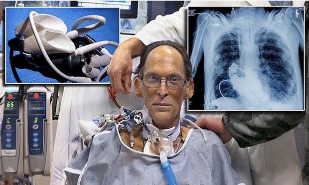 Very interesting secrets about the heart and blood that you have not known for years Picture 1
