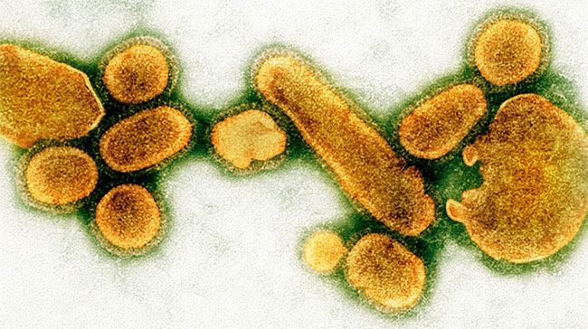 What happens if one day all the viruses disappear? Picture 1