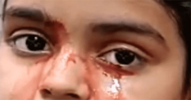 11-year-old girl cries blood in India