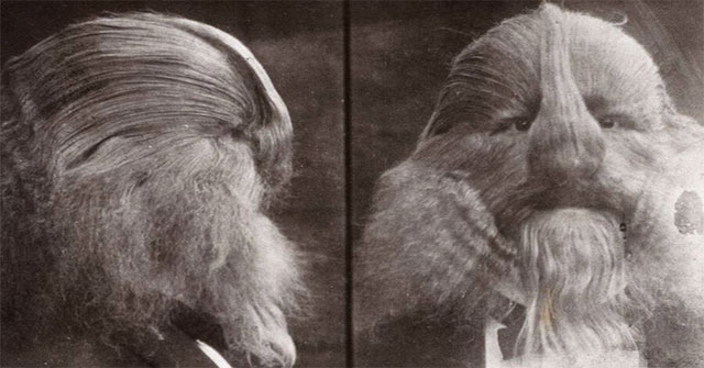 A mysterious life story about a man nicknamed 'The Man with a Lion Face'