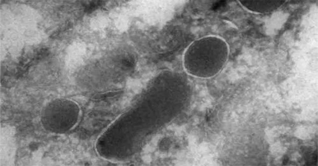 Detect shivers about living things in cancer cells