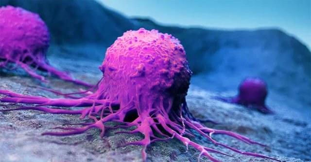 Detecting factors that make Asians more likely to die from two forms of cancer