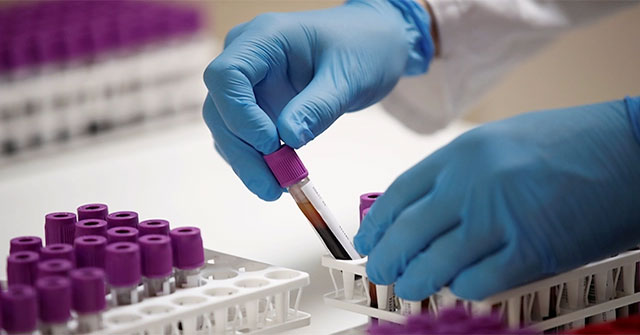 Detecting 'world's strongest' antibodies against Covid-19