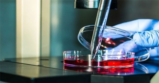 Israel invented electronic skin that can heal itself