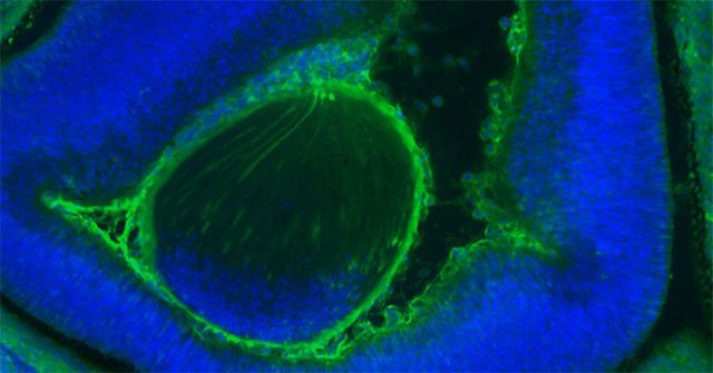 Science has created a mouse carrying human cells