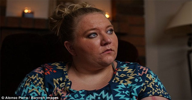 The woman with the most painful disease in the world