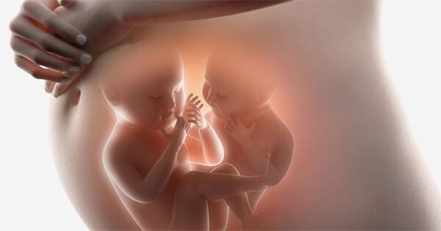 What is twin blood transfusion syndrome?