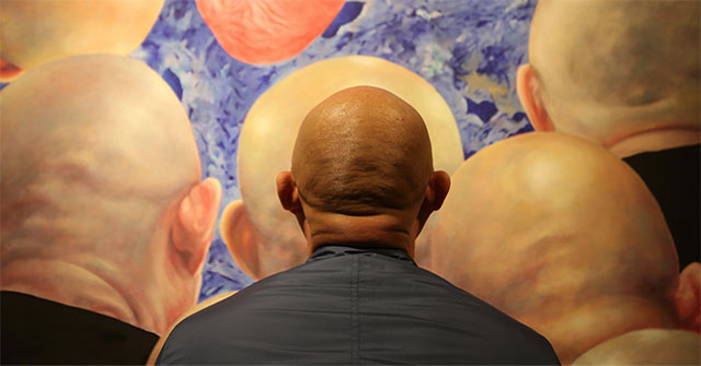 Why are you bald?