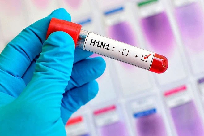 Picture 1 of 2 deadly influenza viruses in humans are almost extinct