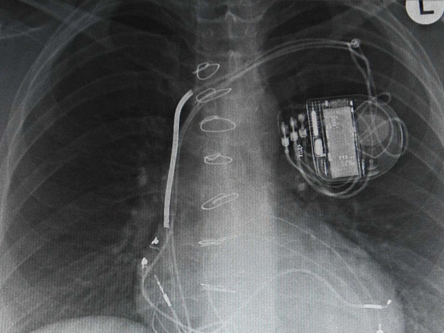 Picture 16 of 23 'accidental and unexpected' inventions that changed the world.
