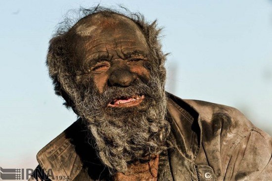 Picture 1 of 60 years without bathing, the body will be like?