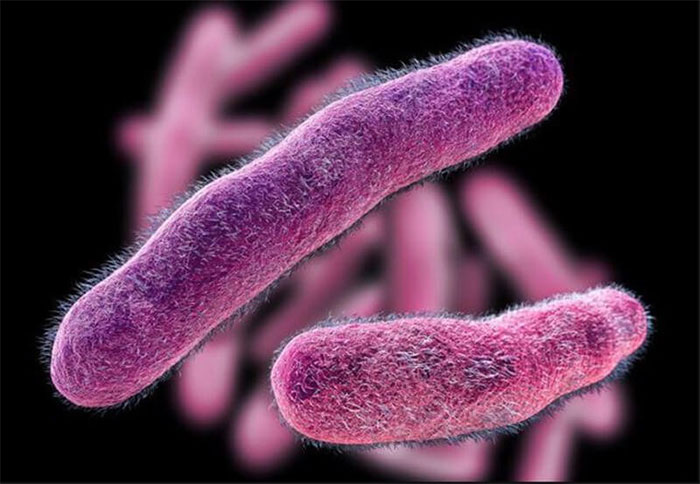 Picture 1 of 7 common bacteria that cause food poisoning