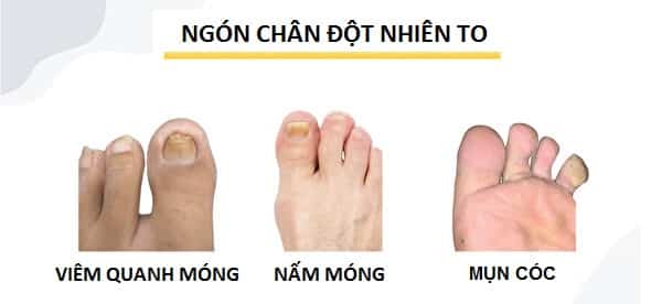 Picture 2 of 8 signs in your feet that warn you of your health
