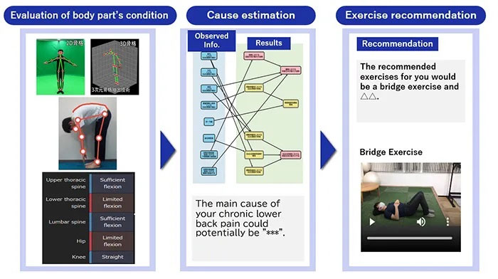 Picture 1 of AI application diagnoses and suggests exercises to treat chronic back pain